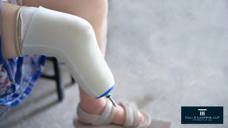 Amputation Injuries After Truck Accidents in Georgia: Calculating Lifetime Costs-image